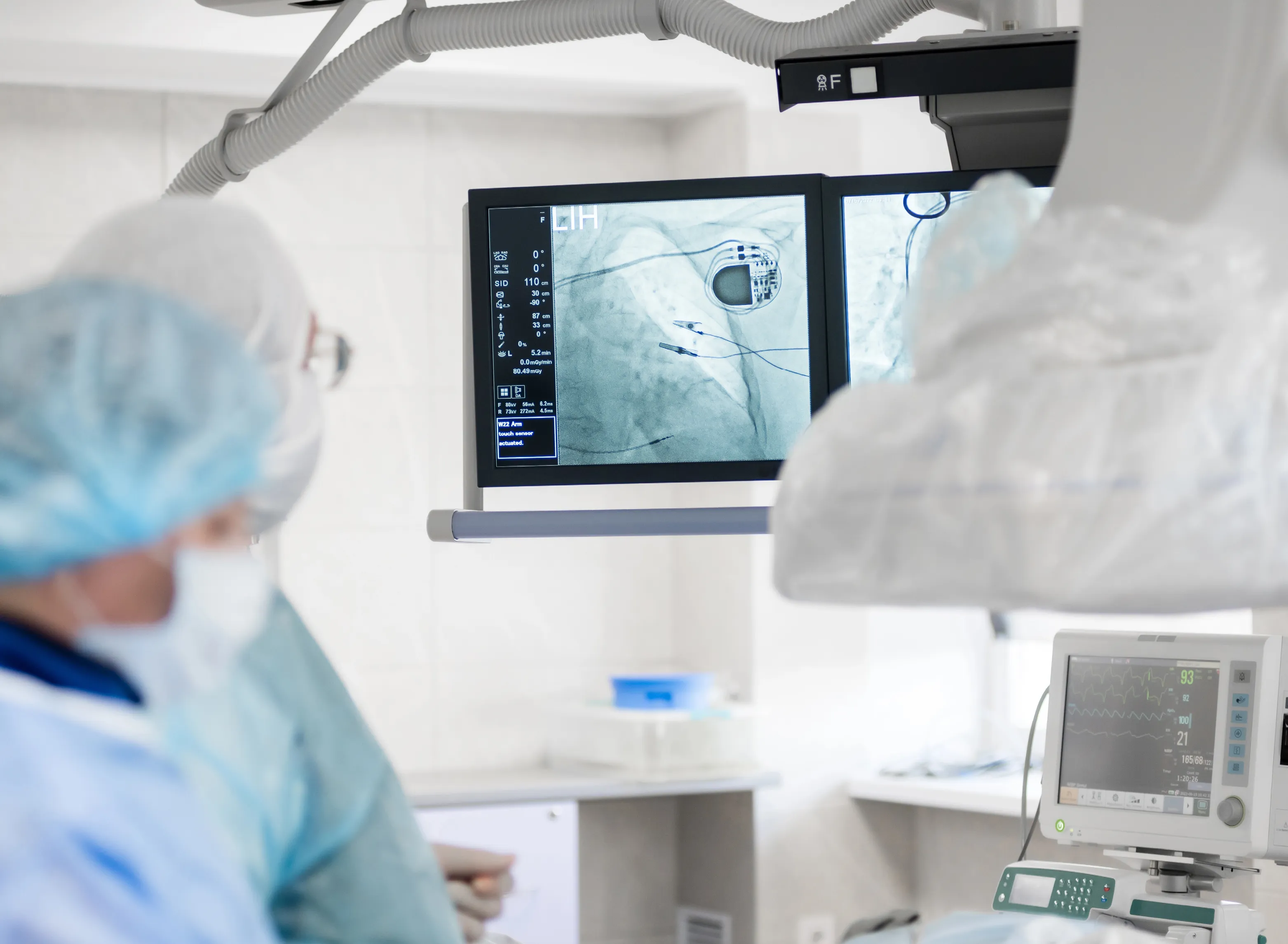 Implantable Cardioverter-Defibrillators in Heart Failure Subtypes